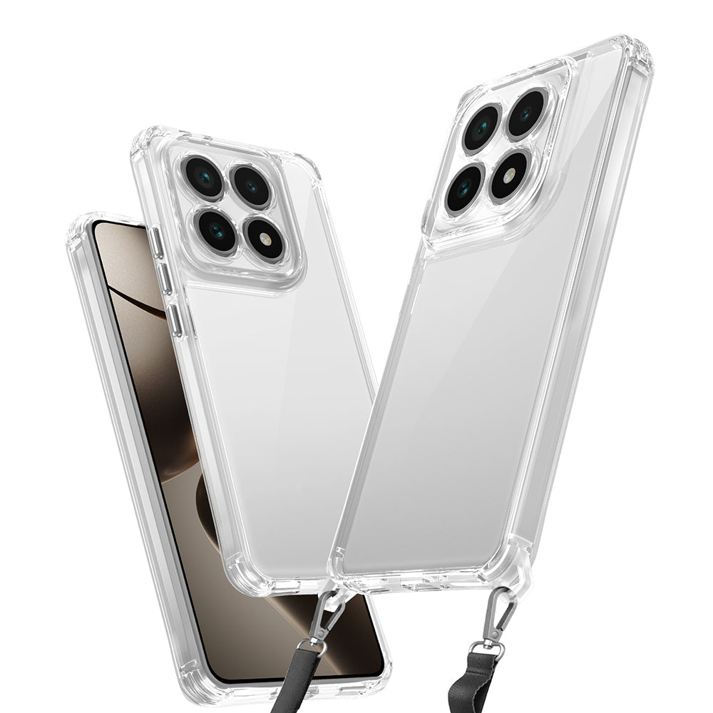 Xiaomi 14T Pro Kılıf Airbagli Takılabilir Askı Aparatlı Zore Snap Silikon Kapak Şeffaf