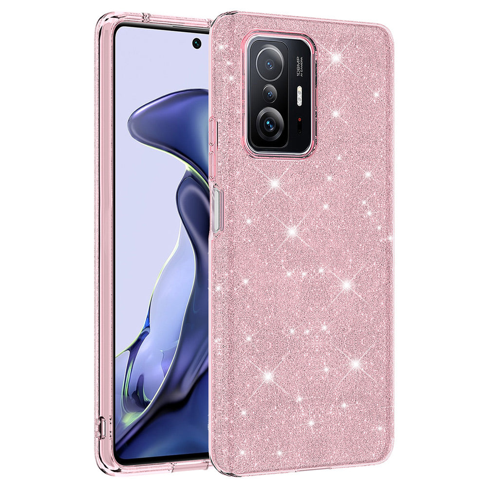 Xiaomi Mi 11T 5G Kılıf Zore Shining Silikon Gümüş