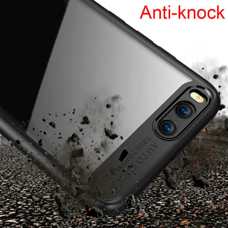 Xiaomi Mi 6 Kılıf Zore Buttom Kapak Pembe